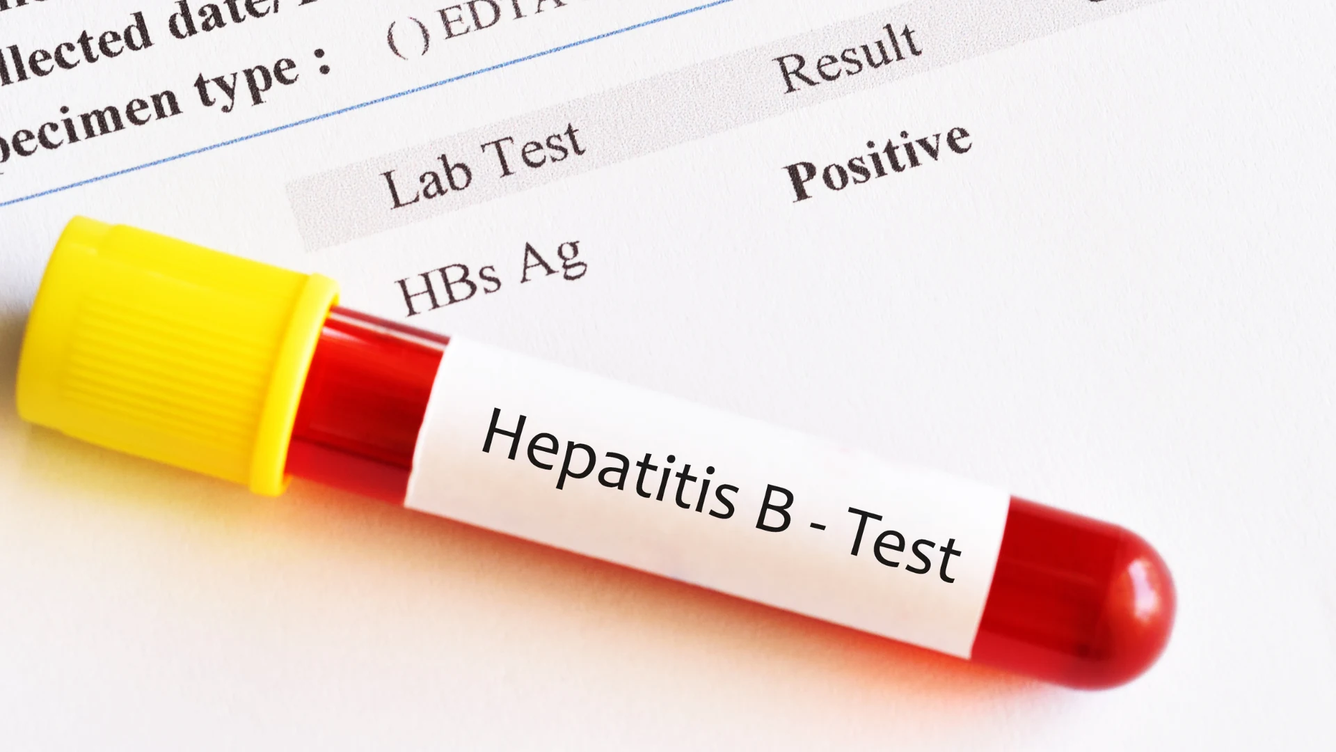 HBsAg Test